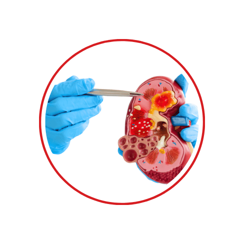 Nephrologist